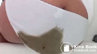 Explosive diarrhea blowout