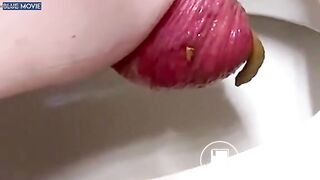girl prolapse poops