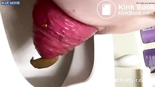 girl prolapse poops