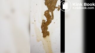 milk enema - video 9