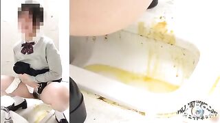 Presence of severe diarrhea