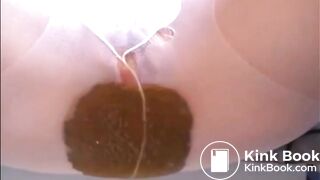 Creamy diarrhea - video 2