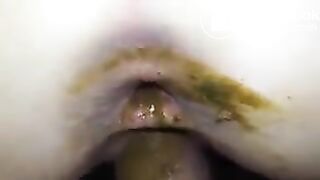 Dirty Ass Slut Gets Pussy Fucked By Shit Covered Cock