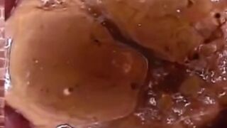 Japanese endoscope scat