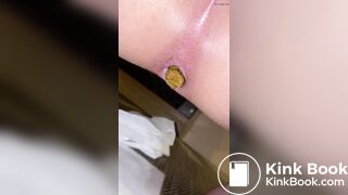 Japanese Twitter College Girl Very Very Big Poop - video 2