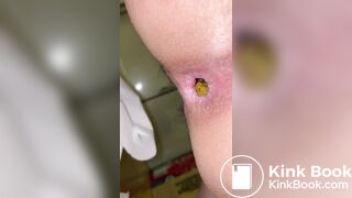 Japanese Twitter College Girl Very Very Big Poop