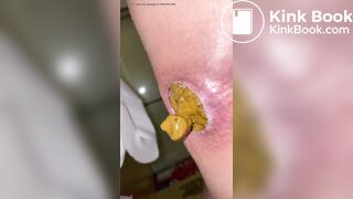 Japanese Twitter College Girl Very Very Big Poop