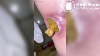 Japanese Twitter College Girl Very Very Big Poop