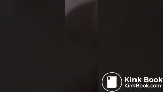 Light skin girl diarrhea