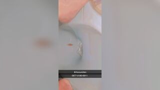 Poop Riview