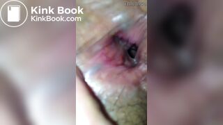 Close Up Inside Womens Asshole