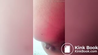 近距离拉屎 自拍1
