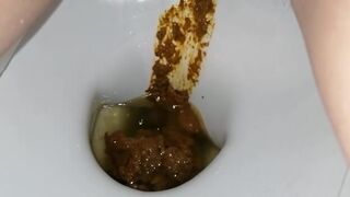 Another ex frontview toilet poop 10