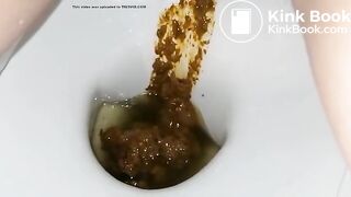 Another ex frontview toilet poop 10