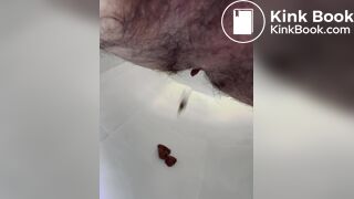 prune diarrhea - video 2