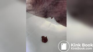 prune diarrhea - video 2