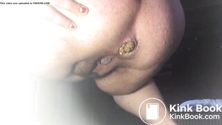 Amateur bbw pooping.@@