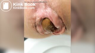 Empty your bowels for me please