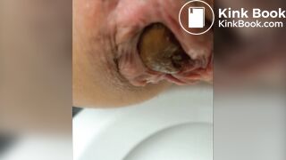 Empty your bowels for me please