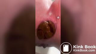 Constipation - video 12