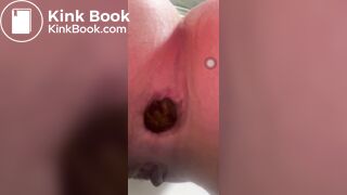 Constipation - video 12