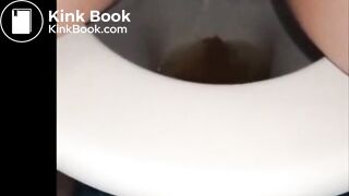 woman shows us her poop