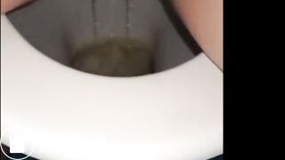 woman shows us her poop
