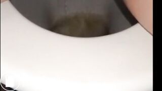 woman shows us her poop