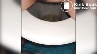woman shows us her poop