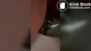 Quick diarrhea self shot