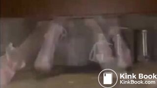 Explosive severe diarrhea