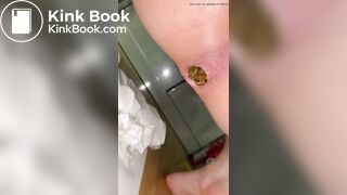 Bedroom floor poop