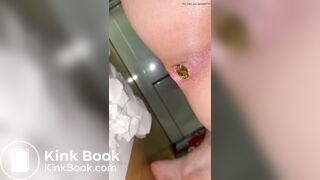 Bedroom floor poop
