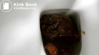 Shit336