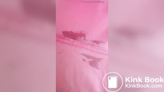 Marshmallow diarrhea eruption