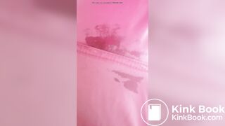 Marshmallow diarrhea eruption