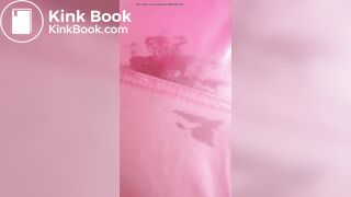 Marshmallow diarrhea eruption