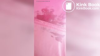 Marshmallow diarrhea eruption