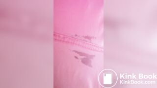 Marshmallow diarrhea eruption