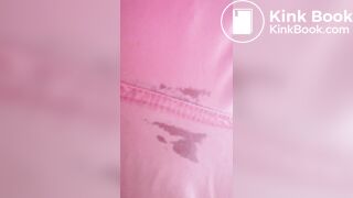 Marshmallow diarrhea eruption