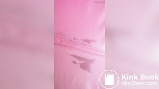 Marshmallow diarrhea eruption