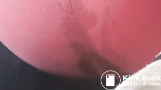 Bubbly diarrhea mush