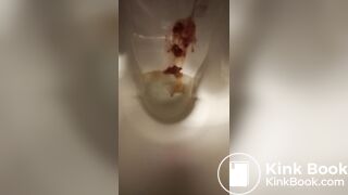 Diarrhea - video 121