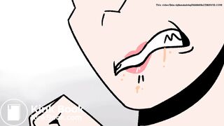 (Animation) Woman Has an Accident