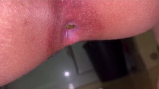 Japanese Girl constipated turd 2