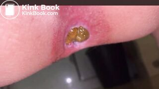 Japanese Girl constipated turd 2