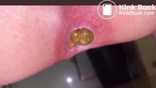 Japanese Girl constipated turd 2