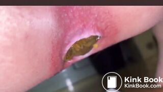 Japanese Girl constipated turd 2