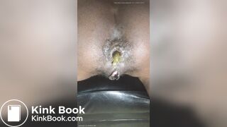 Hairy Ebony Asshole Scat Pooping Outdoor Part- 3