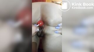 Candy poop, fart, diarrhea complication 1/5